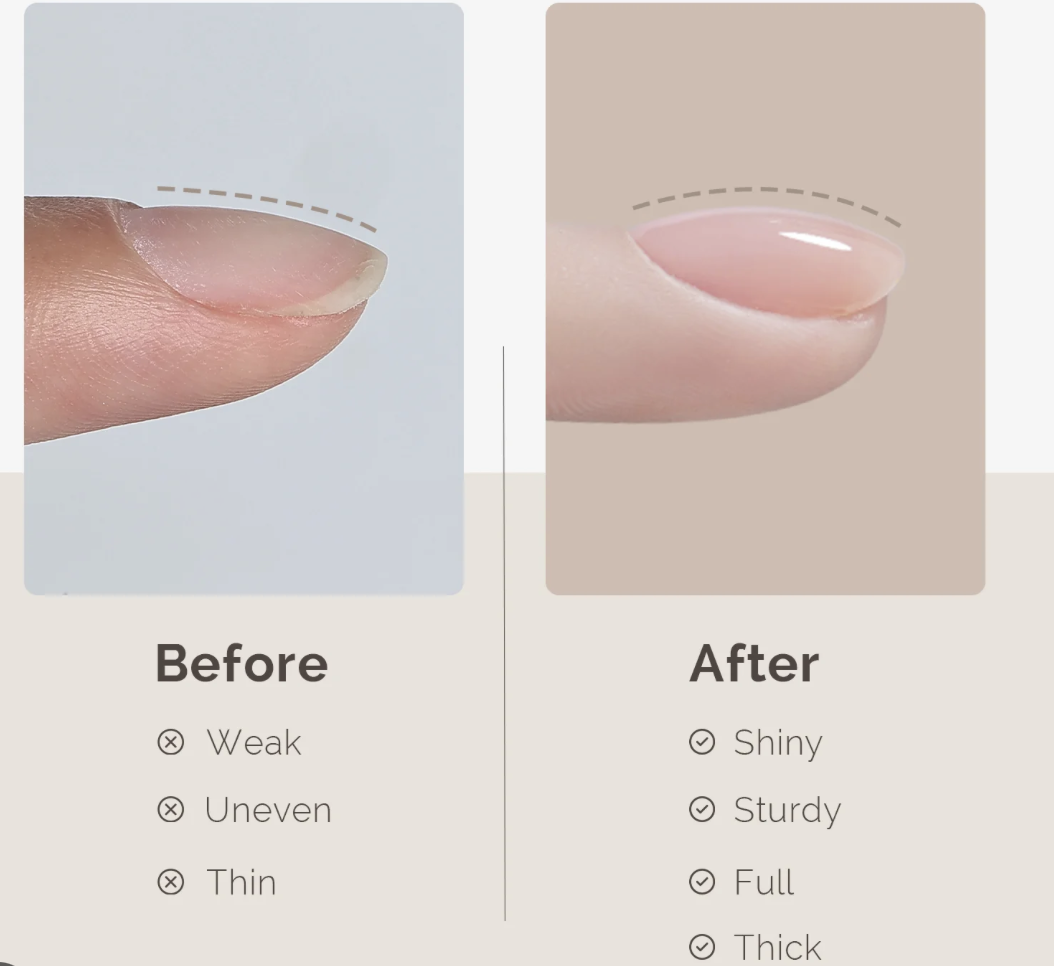 Structure Gel